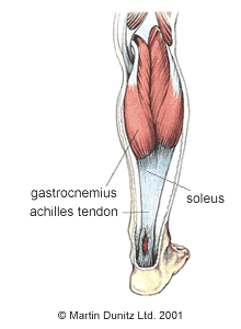 pain in achilles tendon and calf
